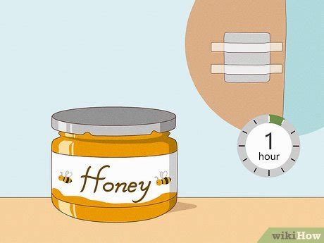 Image result for How to Remove a Bee Stinger
