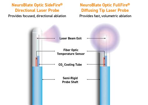 Sensor Tech Laser Probe के लिए छवि परिणाम