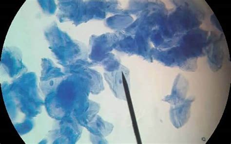 Microscope View of Human Cheek Cell-க்கான படிம முடிவு