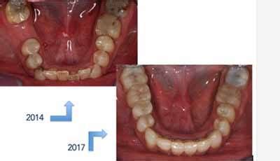 Restricted Envelope of Function に対する画像結果