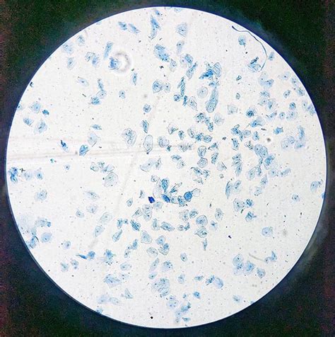 Microscope View of Human Cheek Cell-க்கான படிம முடிவு