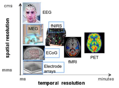 Toradh íomhá ar Spatial Resolution versus Temporal Resolution