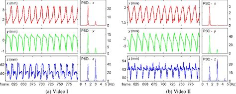 Image result for 3D Cardiac Output Surface