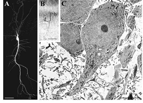 Image result for Neuron Under Electron Microscope