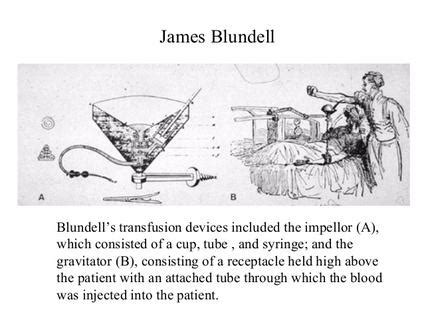 Image result for James Blundell Blood Transfusion