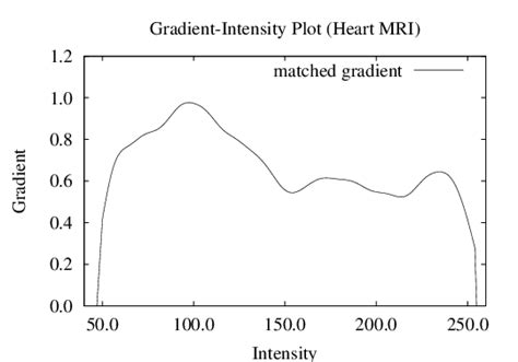 Image result for MRI Gradient Distribution Plot