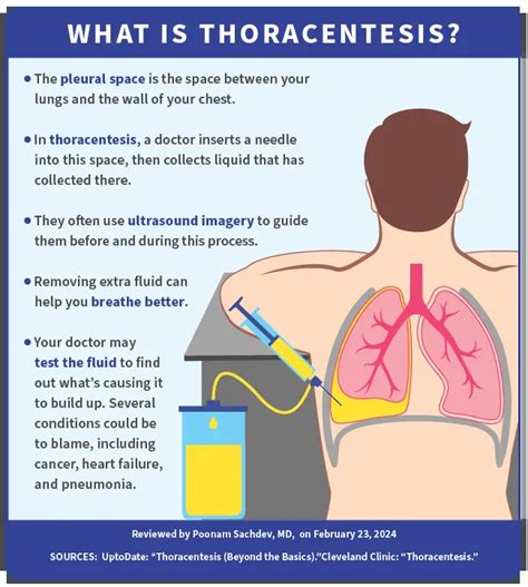 Image result for Thoracentesis Pneumothorax