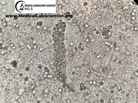 Urine Casts に対する画像結果