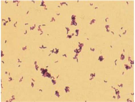 Palisading Bacilli に対する画像結果