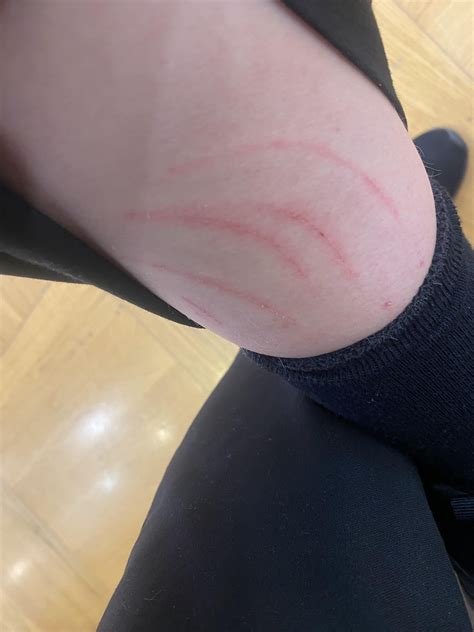 Afbeeldingsresultaten voor Recurring Issue