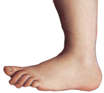 Monty Python Foot TV に対する画像結果