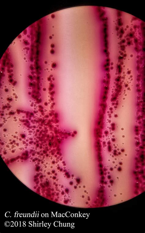 Image result for Coliform On MacConkey Agar