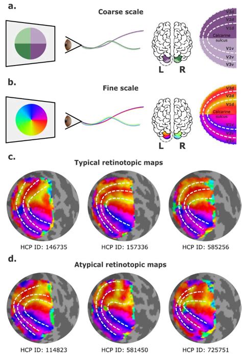 Toradh íomhá ar Visual Cortex Max Olujobi