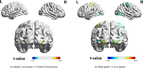 Image result for Frmi Visualisation versus Visual Processing