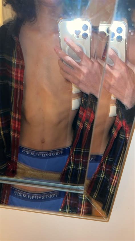 Toradh íomhá ar Nuss Strut Removal