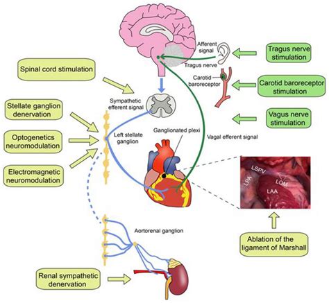 Image result for Autonomic Modulation Heart