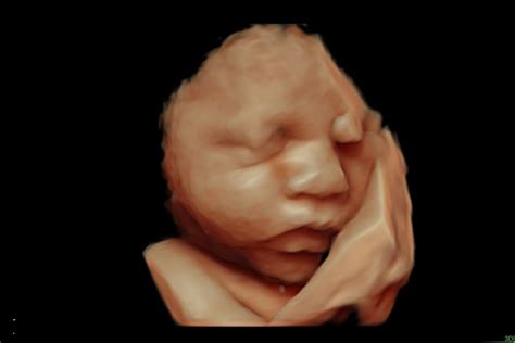 Image result for 3D/4D Ultrasound Exam