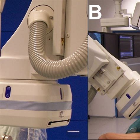 Flat Panel Detector Cath Lab に対する画像結果