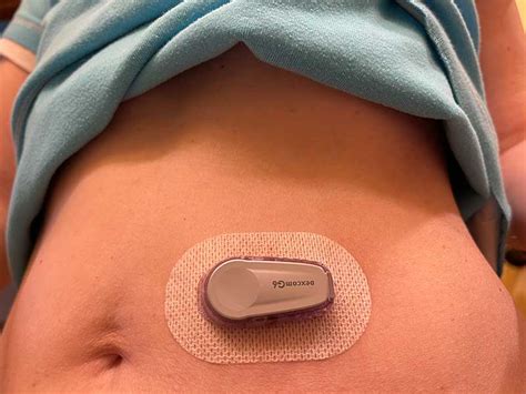 Image result for Dexcom G6 Package