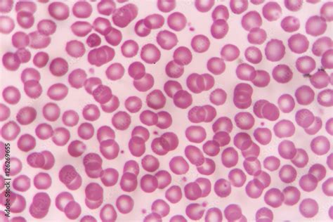 Image result for Blood Cell Using Light Microscope