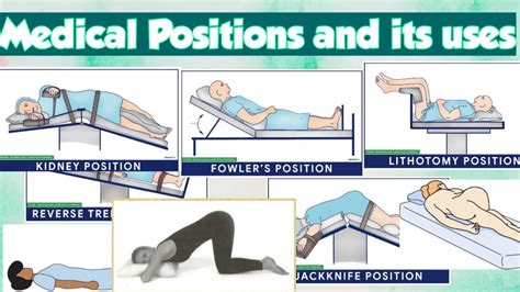 Image result for Patient Positions Bed