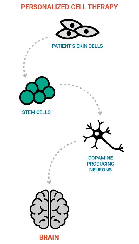 Afbeeldingsresultaten voor Parkinson's Disease Therapy