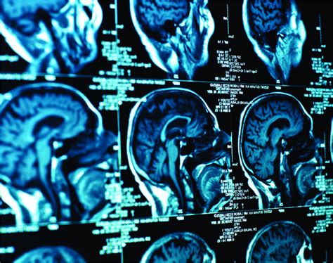 Toradh íomhá ar Python Brain