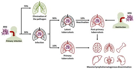 Image result for Tuberculosis Latent Stage