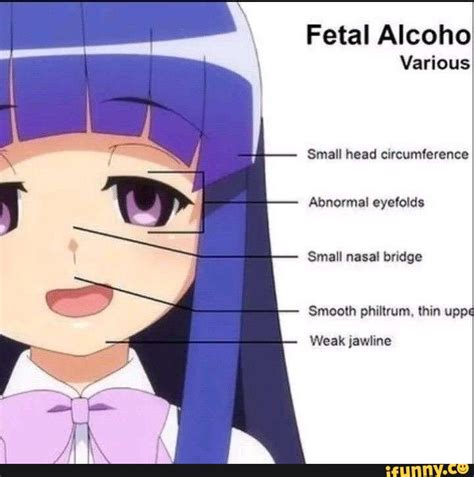 Toradh íomhá ar Abnormal Head Circumference