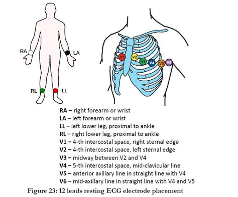 Image result for How to Use ECG Machine