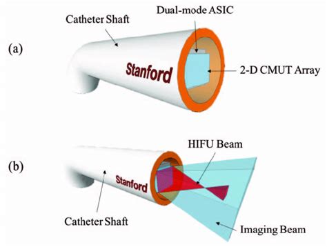 Image result for Flat Rectangular Array HIFU