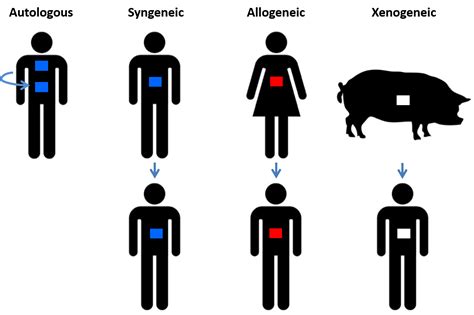 Transplantation Types に対する画像結果