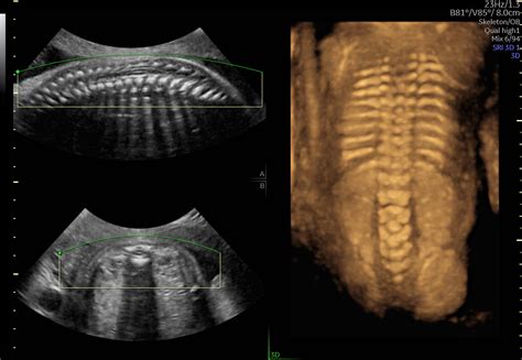 Image result for 3D/4D Ultrasound Exam
