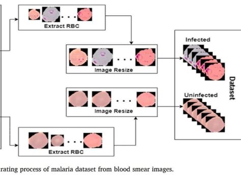 Toradh íomhá ar Differnnce Bertwee Classification and Segmentation in Computer Vision