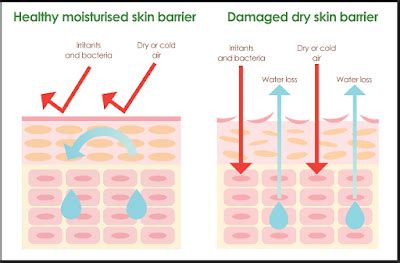 Image result for Barrier Itu APA