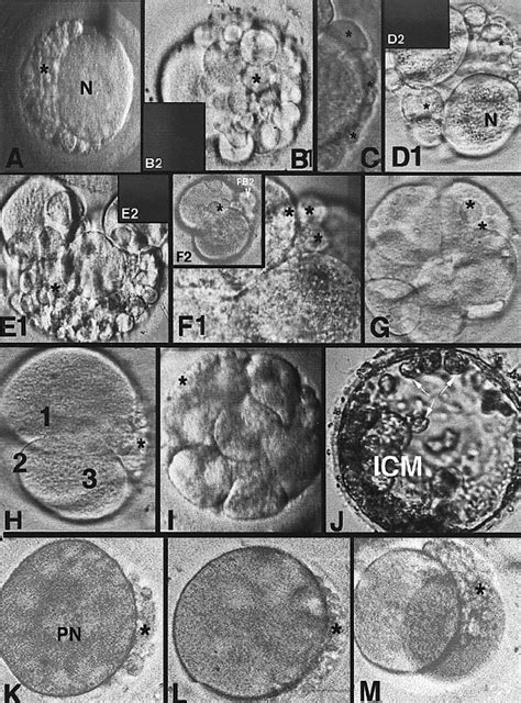 Image result for Human Embryo Electron Microscope