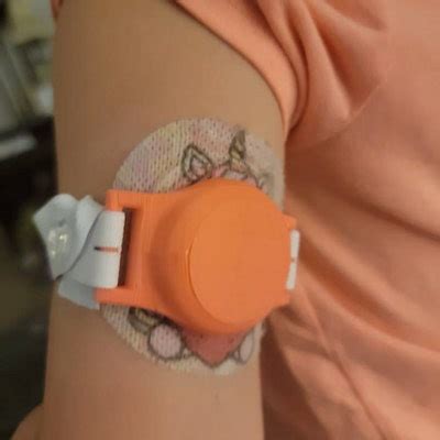 Image result for Dexcom Cover Sleeve