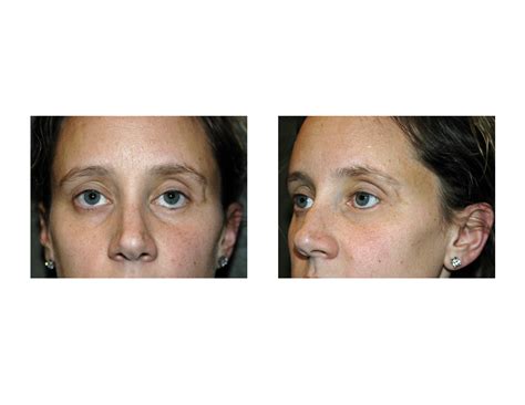 Image result for Cheekbone Deep Color Contour