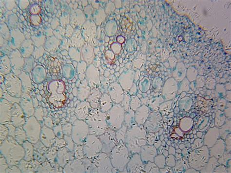 Afbeeldingsresultaten voor Corn Prop Root in Microscope
