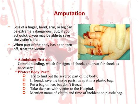 Image result for Open Wounds and Bleeding Types