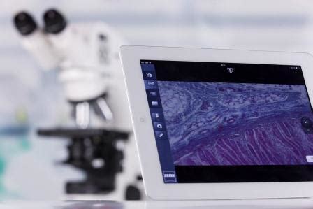 Image result for Max See Microscope App