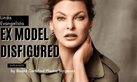 CoolSculpting Model に対する画像結果