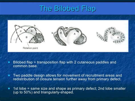 Image result for Bilobed Flap