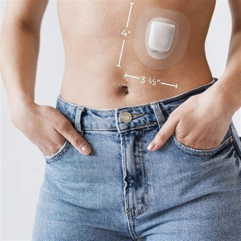 OmniPod 5 Algorithm માટે ઇમેજ પરિણામ