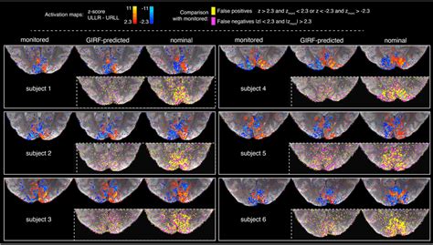 Visual Cortex Activation Map Surface に対する画像結果