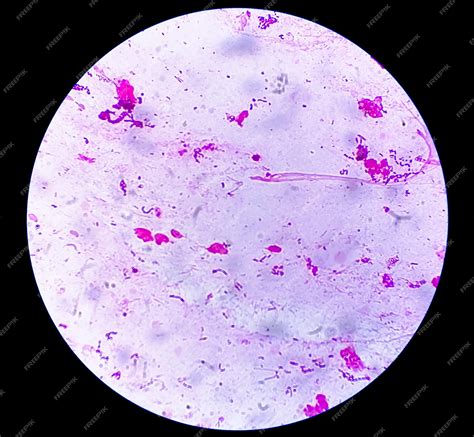 Gram-positive Diplococci に対する画像結果