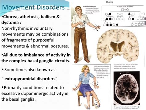 Image result for Psychiatric Movement Disorders