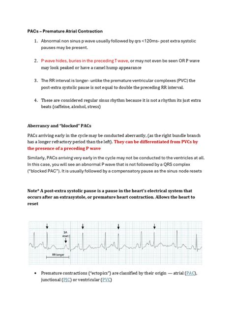 ECG Study Guide PDF に対する画像結果