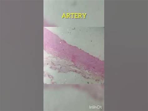 Image result for Hypophyseal Artery Under Microscope