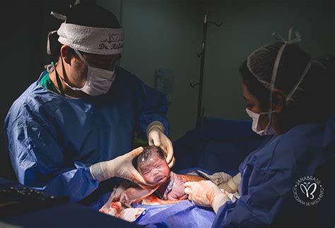 Image result for Head Caul